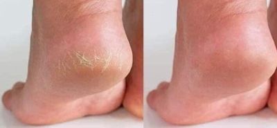 Prouve ХИДРАТИРАЩ КРЕМ ЗА КРАКА 75мл